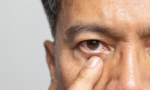 A close-up shot of a man’s brown eye